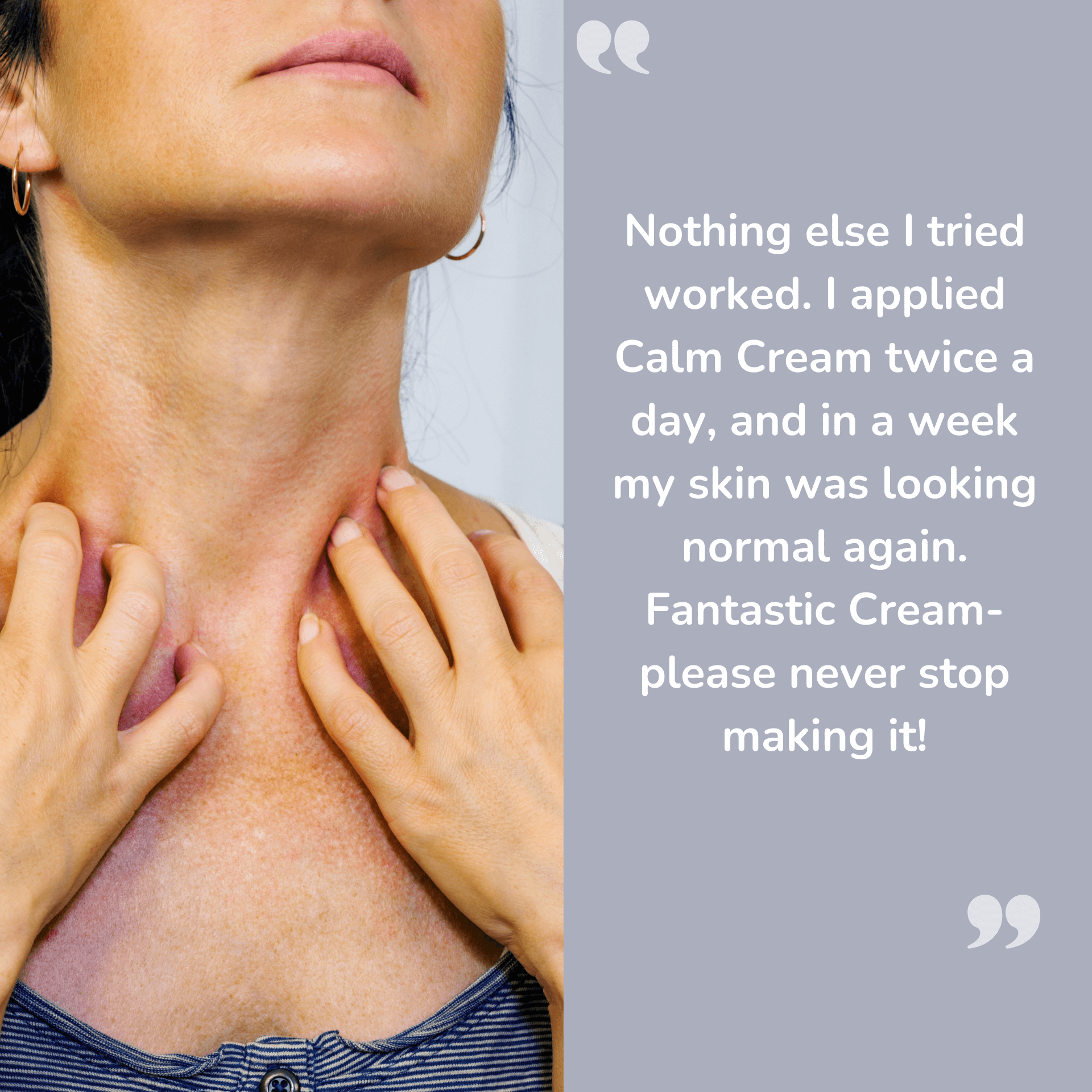 Calm Cream- Best Natural Cream For Dry, Itchy & Sensitive Skin