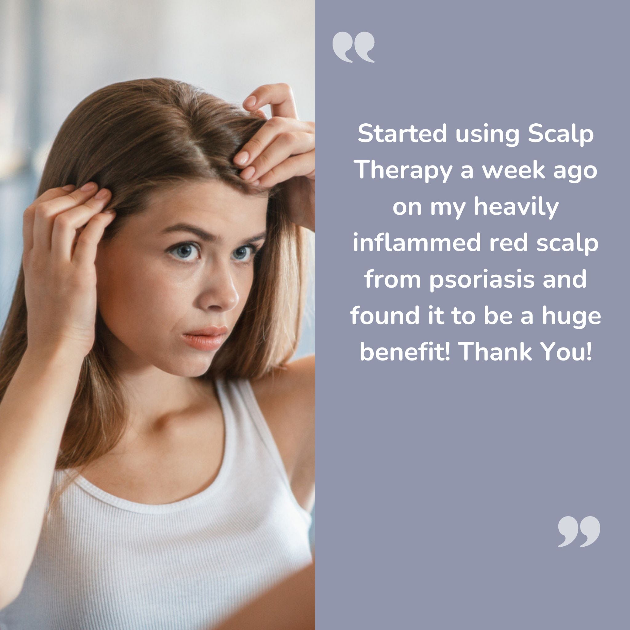 Scalp Therapy- Leave In Treatment For A Dry, Itchy & Dandruff Prone Scalp